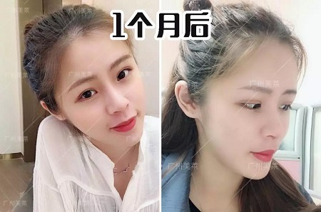 只差1個鼻的距離!