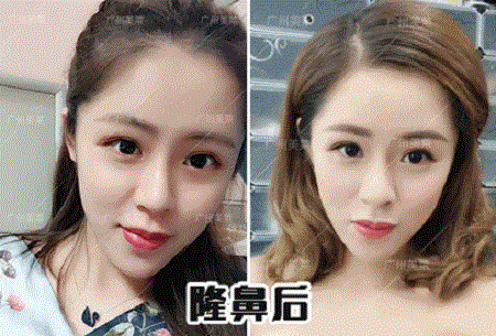 塌鼻土妞到洋氣時尚,只差1個鼻的距離!