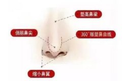 線雕做鼻子效果怎么樣