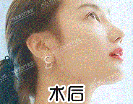 你與仙女只差一個鼻子的距離!