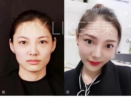 再不糾正,早晚這幾點會毀了你的臉型!