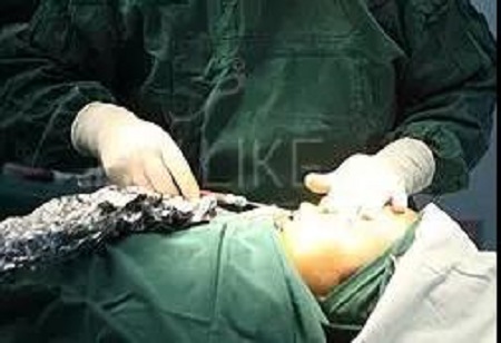 隆鼻后逆襲成女神?