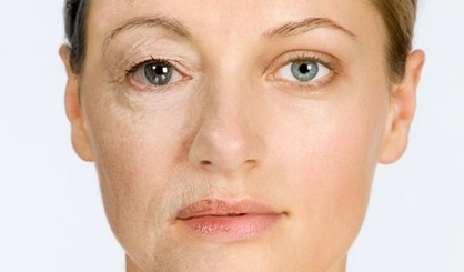 自體脂肪除皺的費用是多少？