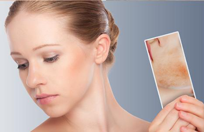 祛黃褐斑的價格大概是多少?