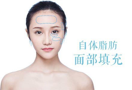 抽脂填充價格是多少?