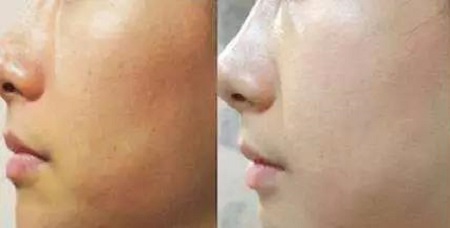 才是SK2+HR+Lamer組成的王炸!