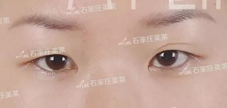 這些眼睛一點(diǎn)都不招人喜歡!