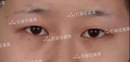 這些眼睛一點(diǎn)都不招人喜歡!