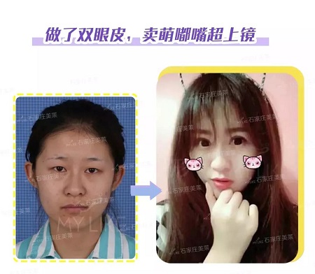 這些眼睛一點(diǎn)都不招人喜歡!