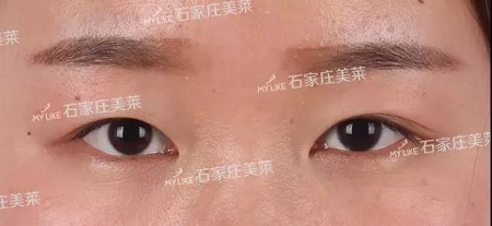 這些眼睛一點(diǎn)都不招人喜歡!