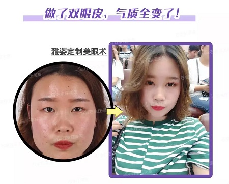 這些眼睛一點(diǎn)都不招人喜歡!