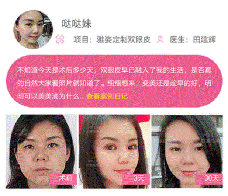 這些眼睛一點(diǎn)都不招人喜歡!