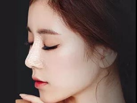 一次隆鼻堪比換頭效果!!!