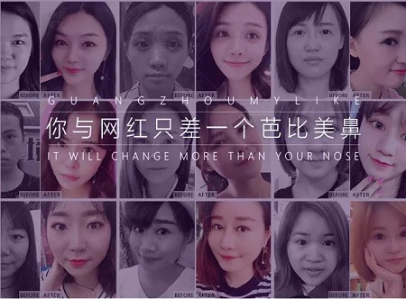 這款美鼻巨撩，讓你為它狂打call！