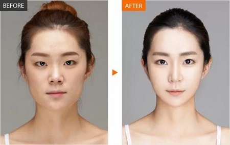  23-24日，韓國較會整容的柳元敏博士，來了！