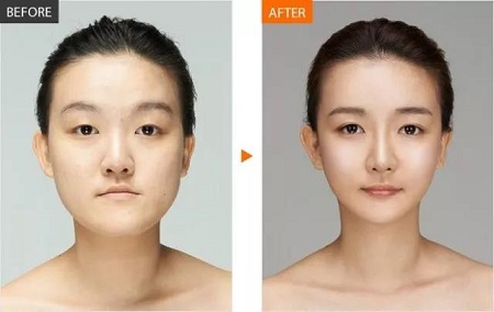  23-24日，韓國較會整容的柳元敏博士，來了！