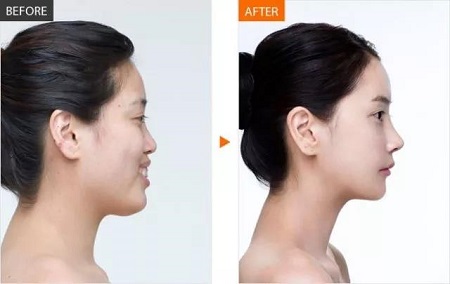  23-24日，韓國較會整容的柳元敏博士，來了！