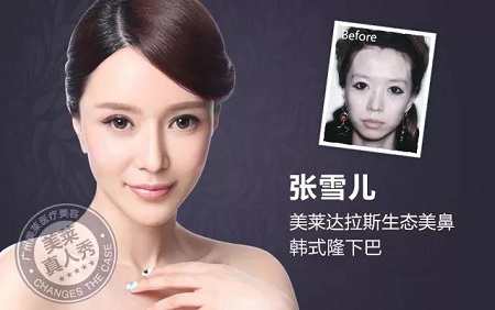  23-24日，韓國較會整容的柳元敏博士，來了！