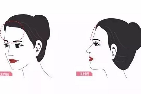 知道么?額頭飽滿的女人好命