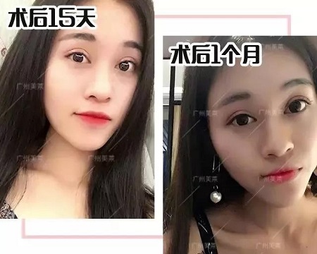 這3種小眼睛開了眼角，電眼迷人1000倍！