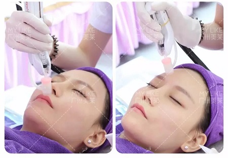 水光、紋眉¥199,超值秒殺拼團(tuán),千萬(wàn)別走寶!