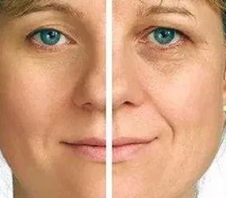 熬較狠的夜，其實也不用買較貴的眼霜！注射玻尿酸和玻尿酸就夠了！