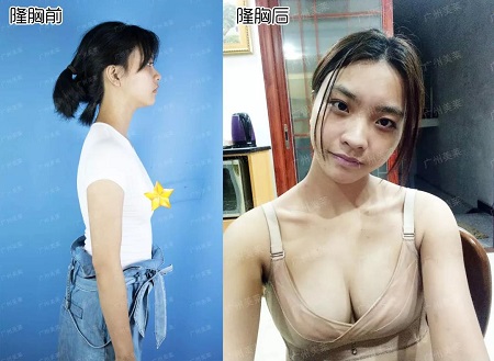 專業打假!所謂的豐胸秘籍是什么?!