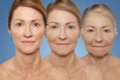 做頸部拉皮除皺多少錢