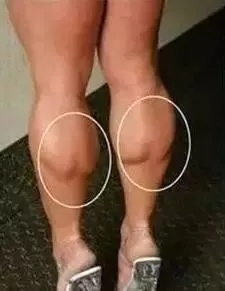 “腿精”不是你想做就能做的,你瘦腿了嗎?