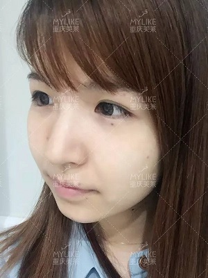 抗初老警報！萬物皆上漲、唯有臉下垂，你還說你不是老阿姨