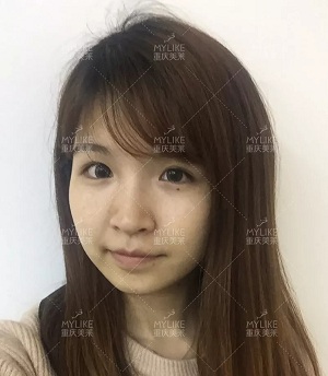 抗初老警報！萬物皆上漲、唯有臉下垂，你還說你不是老阿姨