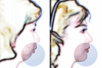 從“側(cè)顏癱”到“側(cè)顏殺”,其實(shí)只需要一點(diǎn)小改變