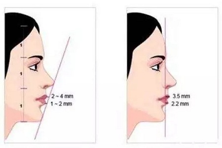 從“側(cè)顏癱”到“側(cè)顏殺”,其實(shí)只需要一點(diǎn)小改變