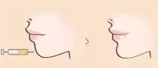 從“側(cè)顏癱”到“側(cè)顏殺”,其實(shí)只需要一點(diǎn)小改變