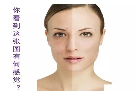 抗衰老的“水光針”究竟為何飽受稱贊？