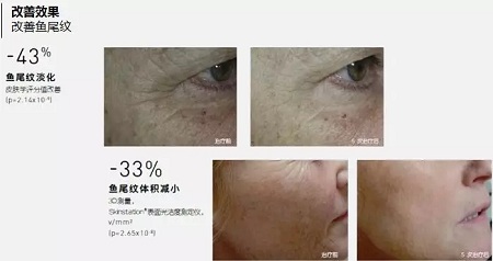 抗衰老的“水光”究竟為何飽受稱贊?