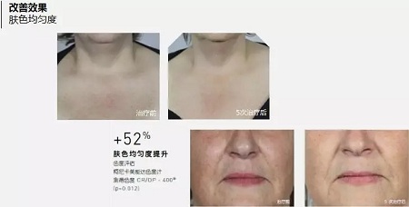 抗衰老的“水光”究竟為何飽受稱贊?