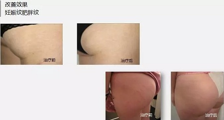 抗衰老的“水光”究竟為何飽受稱贊?