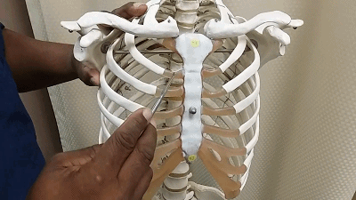 擔心鼻整形假體透光、發紅、移位?了解下自體軟骨