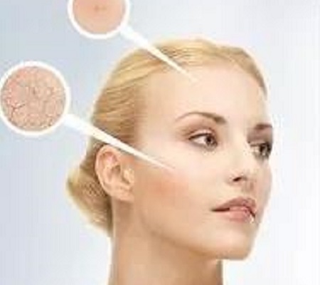 打完玻尿酸臉會變僵?問題在于....