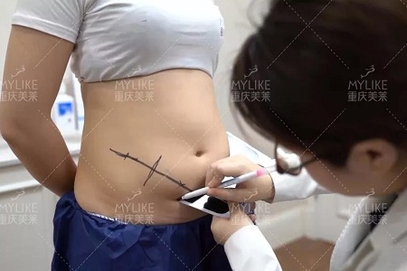 瘦身Flag挑戰賽 | “躺著就能瘦”真的不是夢，人人都可以！