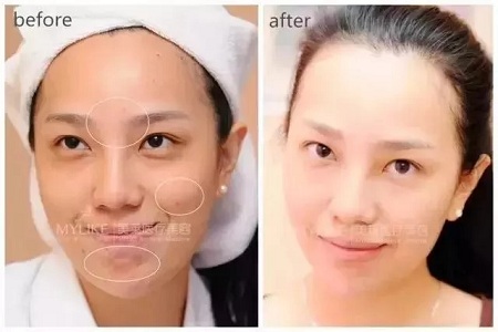 沒有誰能永遠年輕,不老都是保養的早!