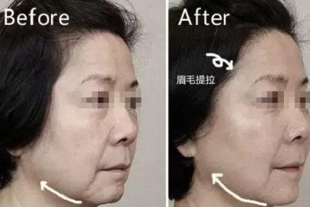 沒有誰能永遠年輕,不老都是保養的早!