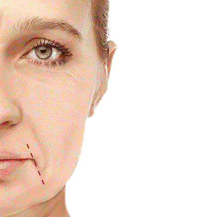 敷面膜千萬不能做的4件事!不然越敷皮膚越差!