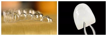 矯正 PK 牙貼面！關(guān)閉牙縫應(yīng)該pick哪一個(gè)？