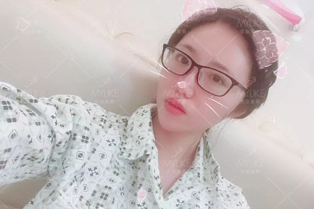 顏值:金剛如何化身長腿女神?