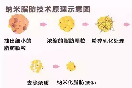 拿什么拯救你,我的黑眼圈?