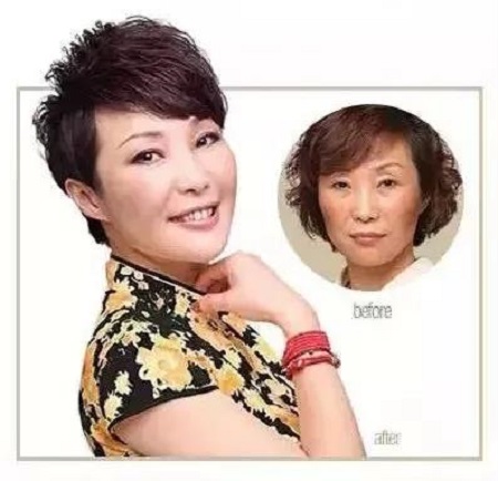 天天喊著要除皺的你,確定抗衰做到位了么?