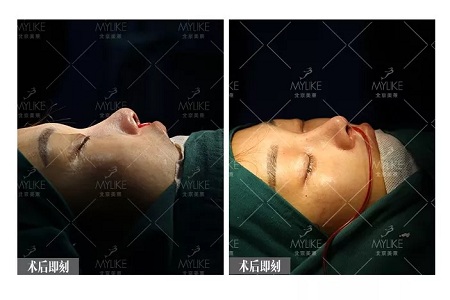 顏值:鼻子的改變能讓一個女孩變化有多大?