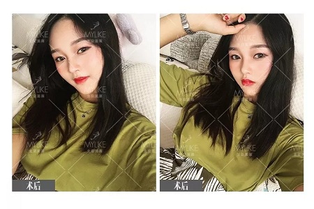 顏值:鼻子的改變能讓一個女孩變化有多大?